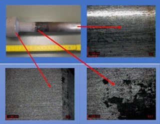 Microscopic examination