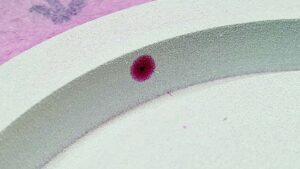 Dye penetrant testing can reveal defects, such as in this RTJ end flange on a valve body